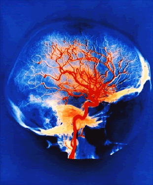 Parkinson e Alzheimer scoperte nuove cure
